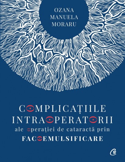 Dr. Ozana Moraru - Complicațiile intraoperatorii ale operatiei de cataractă prin facoemulsificare - Curtea Veche Publishing
